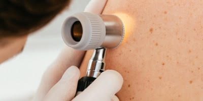 Our new skin cancer clinic with specialised skin GP is now open