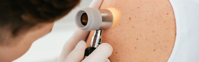 Our new skin cancer clinic with specialised skin GP is now open